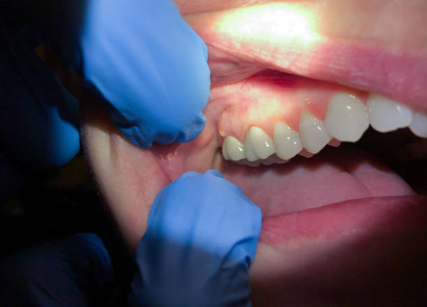 Best Walk-In Emergency Dentist in Audubon Park, KY