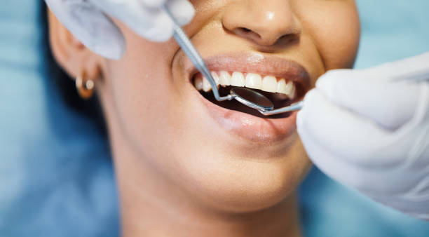 Best Emergency Root Canal Treatment in Audubon Park, KY
