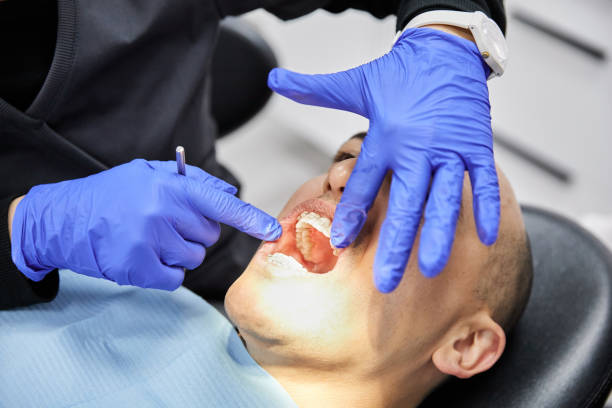 Best Emergency Wisdom Teeth Removal in Audubon Park, KY