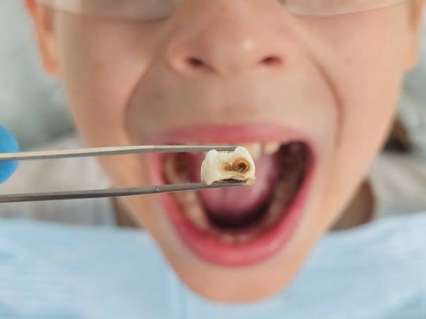 , KY Emergency Dentist Company